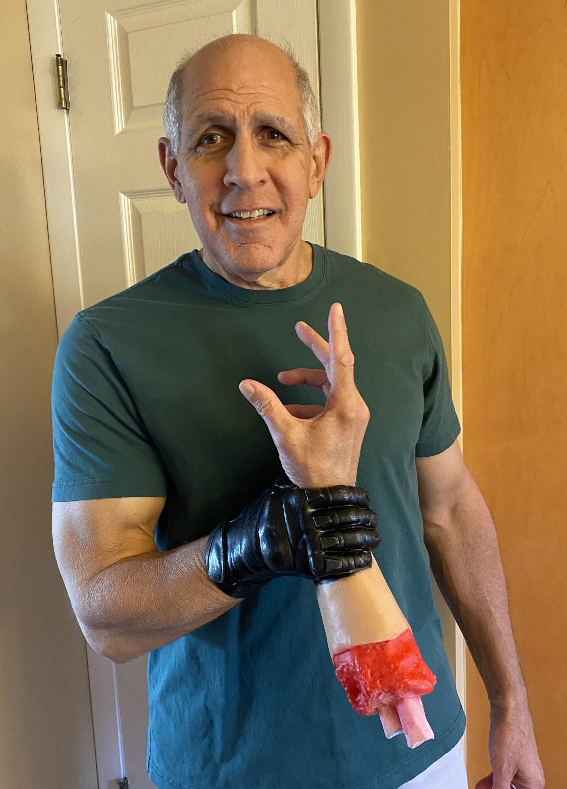 The Living Severed Arm